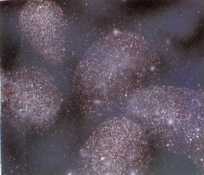 Related Image