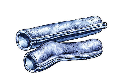 Related Image
