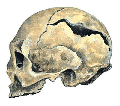 Related Image